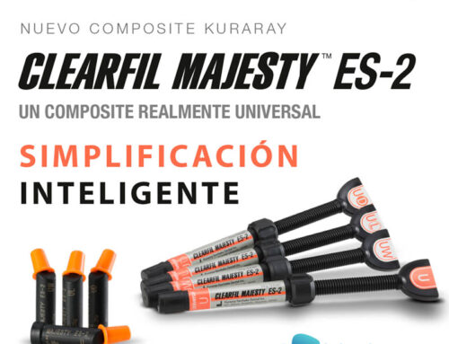 ¿Por qué es tan sencillo trabajar con el composite dental universal Clearfil Majesty ES-2?