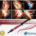 composite Clearfil Majesty Flow