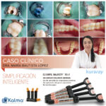 composite dental universal