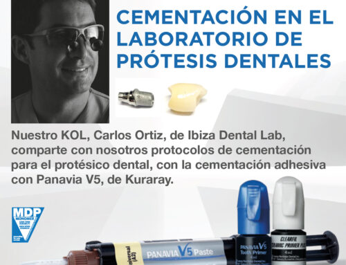 «Cementación en el laboratorio de prótesis dental» por Carlos Ortiz (Ibiza Dental Lab)