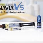 flujo digital dental adhesión y cementación dental kuraray