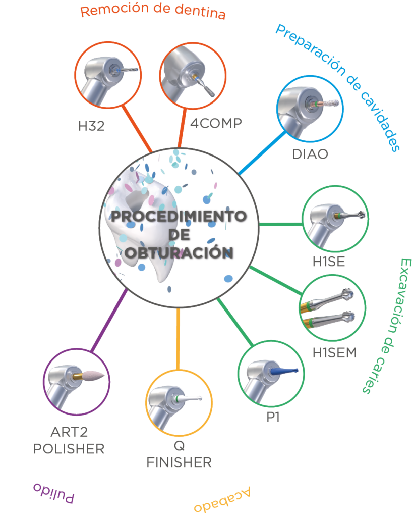 esquema filling procedure