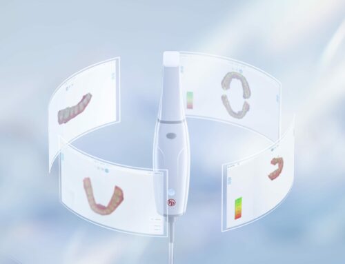 Smile Scan de KP: la revolución del escaneo intraoral